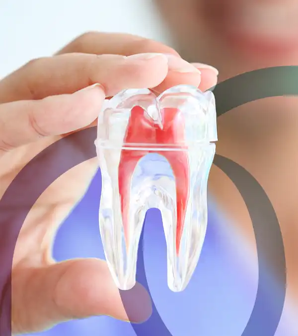 Endodontia - Bonassi Odontologia