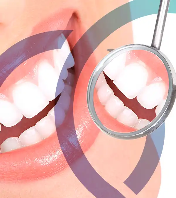Periodontia - Bonassi Odontologia
