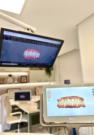 Fluxo digital e iTero – Bonassi Odontologia Integrada Fluxo digital e iTero